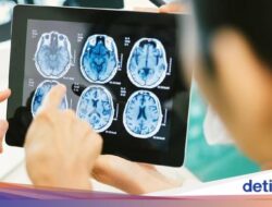 Pasien Tumor Otak Ke RI Banyak Alami Tanda Awal Sakit Kepala, Begini Bedanya