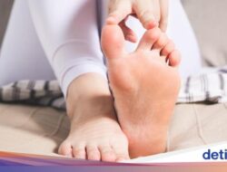 7 Perawatan Cantengan Kaki yang Ampuh dan Aman Digunakan