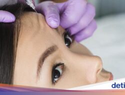 Suntik Botox VS Filler, Mending Mana Bagi Atasi Kerutan Di Wajah?