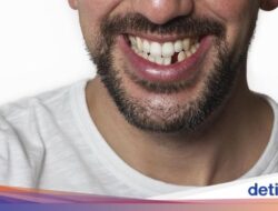Pertama Kalinya, Ilmuwan Bakal Uji Coba Terapi Penumbuh Gigi Ke Manusia