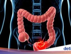 11 Cara Membersihkan Usus Kotor, Bikin Pencernaan Menjadi Lancar!