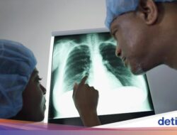 Sudah Kena Penyakit Paru Kronis, Gimana Biar Paru-paru Kembali Bersih?