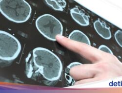 Misteri Hingga Balik Otak Manusia Lebihterus Menyusut, Inikah yang Bersama Sebab Itu Penyebabnya?