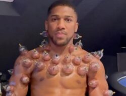 Anthony Joshua Lakukan Bekam, Terapi Warisan Nabi Muhammad