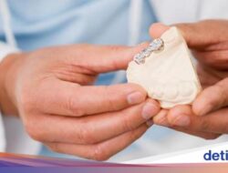 Tambalan Gigi Lepas? Jangan Panik, Ini yang Harus Dilakukan!
