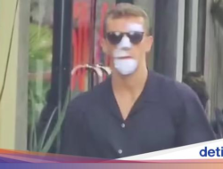 Viral Bali Kiss, Ketika Bule ‘Pamer’ Perban Sebab Jatuh Di Kendaraan Bermotor Roda Dua