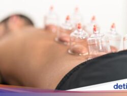 Apa Itu Terapi Bekam? Ini Manfaat, Metode, dan Efeknya