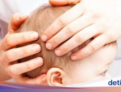 Apakah Benjolan Ke Dibelakang Kepala Bayi Bahaya? Ini Penyebabnya