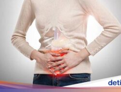 8 Ciri Ciri Asam Lambung yang Parah, Nggak Boleh Disepelekan!