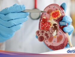 Kakek Umur 70 Punya Ginjal Berusia Nyaris 100 Tahun, Cerita Di Baliknya Haru