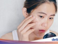 Ternyata Ini Pemicu Kerutan Hingga Wajah Cepat Muncul Meski Usia Mutakhir Masuk Kepala 3
