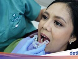 Implan Gigi Digital Solusi Sebagai Si Gigi Ompong