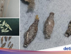 6 Tanda Gatal akibat Kamitetep dan Cara Mengobatinya
