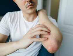 Kulit Gatal Bisa Karena Itu Tanda Sakit Ginjal, Jangan Asal Garuk!