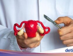 Waspada! Menstruasi Tak Normal Bisa Berpotensi Sebagai Miom & Kista Ovarium