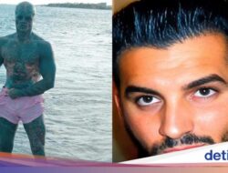 Pria Jalani Modifikasi Tubuh Untuk Mirip Alien, Nekat Potong Jari hingga Hidung