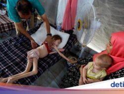 Potret Pilu Anak-anak Ke Gaza Menderita Malnutrisi