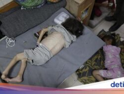 Potret Pilu Anak-anak Palestina Menderita Malnutrisi Akut