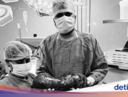 Awal Mula Pria 30-an Idap Tumor Testis Raksasa 40 Cm, Begini Kondisinya