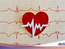 Kapan Perlu Pasang Ring Jantung? Ini Kata Praktisi Medis Kardiologi