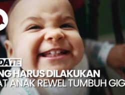 Anak Rewel Pada Tumbuh Gigi, Harus Bagaimana?