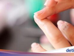 4 Perubahan Ke Kuku yang Bisa Bersama Sebab Itu Pertanda Gangguan, Jangan Diabaikan!