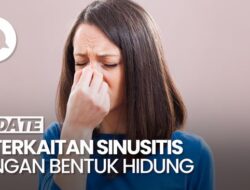 Apakah Operasi Sinusitis Bakal Mengubah Bentuk Hidung?