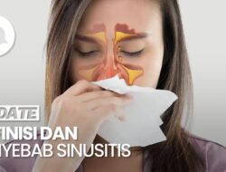 Mengenal Apa Itu Sinusitis dan Penyebabnya