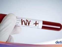 Stigma Negatif Komunitas Didalam Sebab Itu Salah Satu Kendala Besar Penanggulangan HIV Di RI