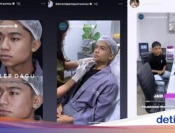 Betrand Peto Jalani Filler Dagu Biar Lebih Maskulin, Bagaimana Prosesnya?