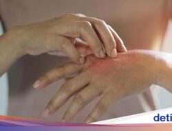 Penyebab, Tanda, dan Cara Mengobatinya