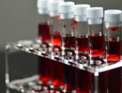 Kebutuhan Meresahkan, Indonesia Masih Perdagangan Masuk Negeri Albumin Di Luar Negeri