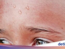 9 Penyebab Keringat Dingin serta Cara Mengatasinya