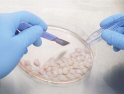 Stem Cell Mesenkimal Kini Karena Itu Terapi Regeneratif Untuk Kerusakan, Disfungsional, dan Kerusakan Organ Tubuh