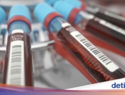 Wanita Ini Iseng Lakukan Tes DNA Hingga Pasangan, Hasilnya Bikin Kaget