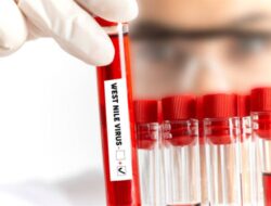 Mikroba West Nile yang Mewabah Hingga Israel Belum Ada Terapi dan Vaksinnya