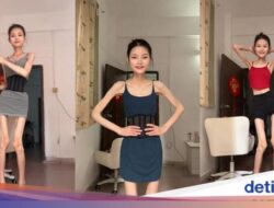 Bak ‘Kerangka Hidup’, Wanita China Ini Berat Badannya Cuma 25 Kg