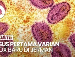 Video: Jerman Identifikasi Peristiwa Pidana Hukum Pertama Varian Mpox Mutakhir