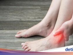 4 Air Rebusan Daun Sebagai Menurunkan Asam Urat, Salah Satunya Sirsak