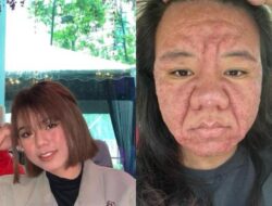 Viral Bumil Curhat Wajahnya Berubah Di Hamil, Insecure seperti Beda Orang