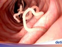 Kenali 5 Cacing dan Bakteri yang Sering ‘Bersembunyi’ Di Hidangan