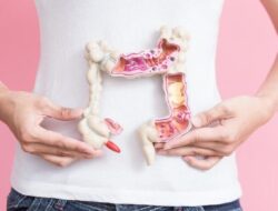Praktisi Medis Beberkan 5 Tanda Kanker Usus Besar Ke Anak Muda yang Sering Diabaikan