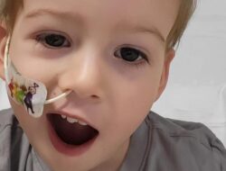 Kisah Pilu Bocah Umur 2 Tahun Alami Stroke, Ini Pemicunya