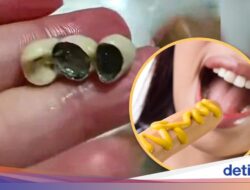 Bikin Mual! Pelanggan Temukan Gigi Manusia Ke Kue dan Sosis