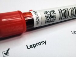 Benarkah Kusta Mudah Menular dan Bagaimana Mencegahnya? Simak Panduan Ini