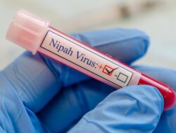 Ilmuwan China Klaim Temukan Perawatan yang Efektif Lawan Mikroba Nipah