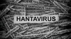 IDAI Imbau Tak Khawatir Soal Hantavirus, Masalah Difteri-Campak Lebih Darurat