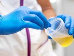 Cek Urine Sekarang! Jika Berwarna Seperti Ini, Bisa Dari Sebab Itu Tanda Ginjal Rusak