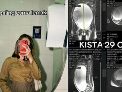 Wanita Bekasi Usia 23 Kena Kista Ovarium Sebesar 29 Cm, Ngaku Kesenangan Makan Ini