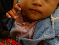 Operasi Bibir Sumbing Gratis Hadirkan Senyum Terbaru Untuk Anak-anak